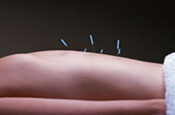Acupuncture | Therapeutic Acupuncture | Cosmetic Acupuntcure | EMG Testing | Langhorne